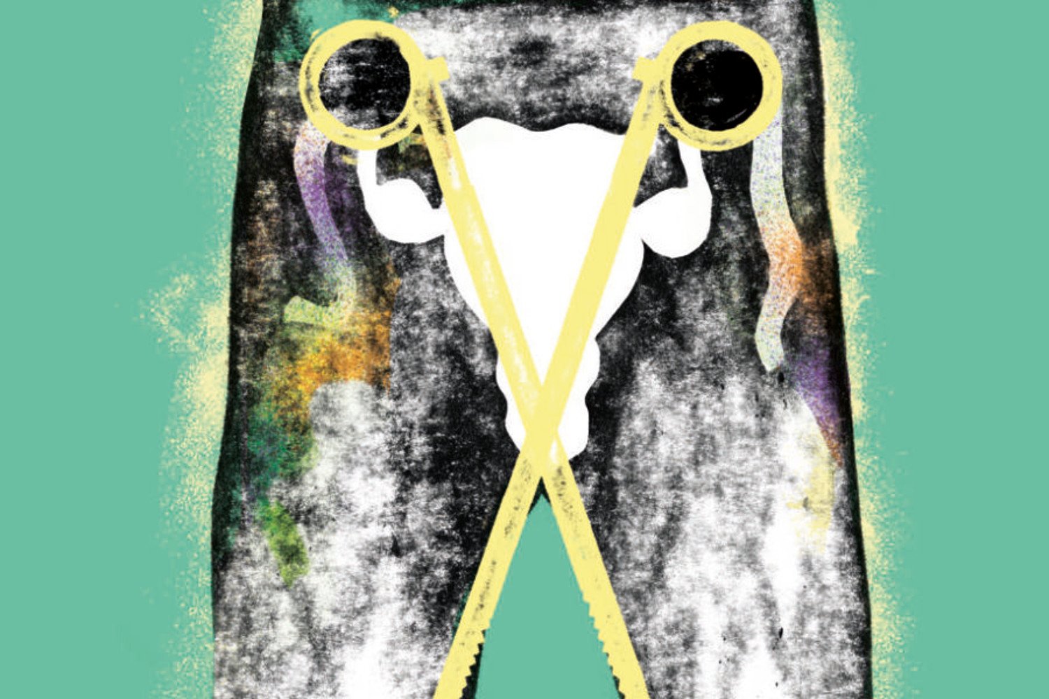 Stérilisations et contraception forcées